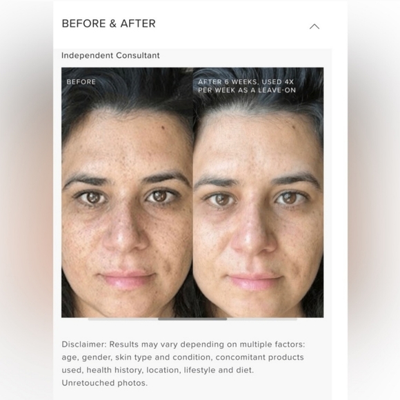 FACE PEEL R+F Multi-Acid Enzyme Peel New in Box Sealed - Picture 10 of 15